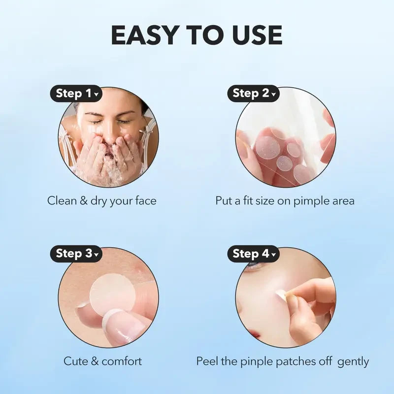 QUSTERE Pimple Patches